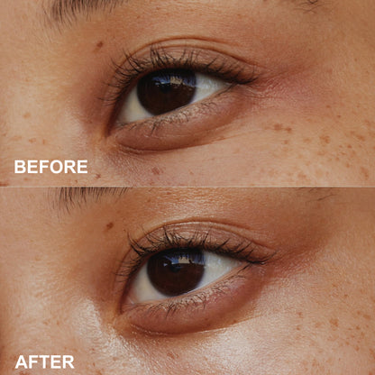 PHOFAY Anti-Wrinkle Moisturizing Eye Cream - Hydrating Under Eye Treatment